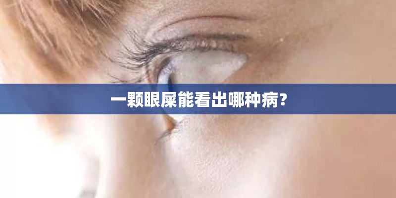 一颗眼屎能看出哪种病？