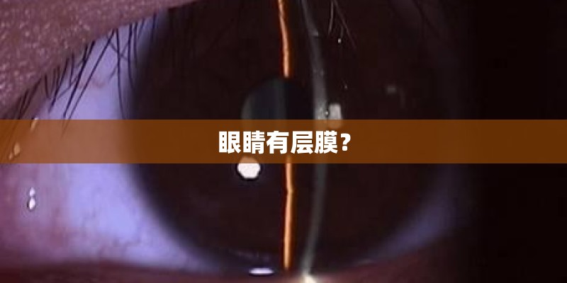 眼睛有层膜? 眼睛有层膜?